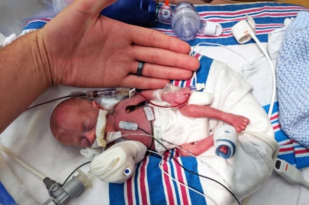 Miracle Baby Born Weighing Just 11 Ounces Finally Heads Home After 9-Month Hospital Stay
