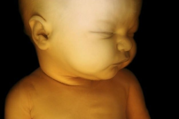 Louisiana Legislature Passes Bill Banning Abortions When Unborn Baby’s Heartbeat Begins