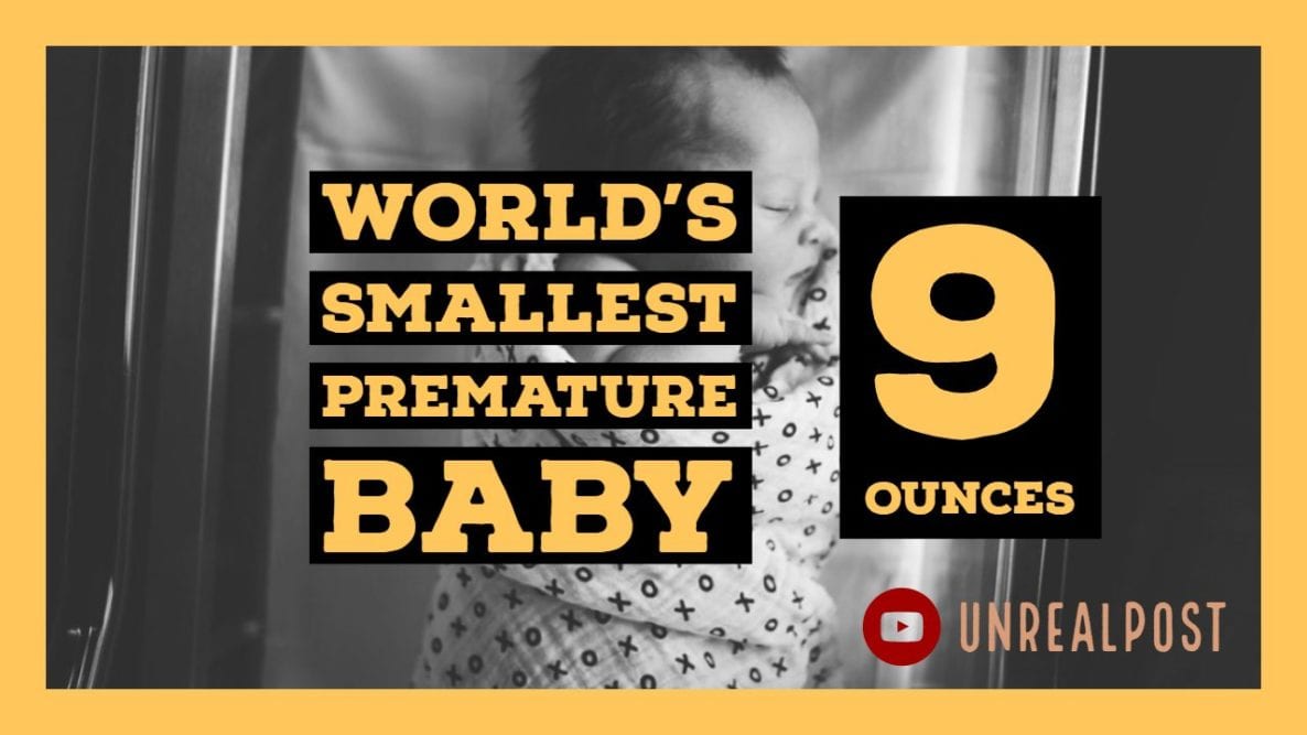 World’s Smallest Baby Only 9 Ounces Survives and Head’s Home