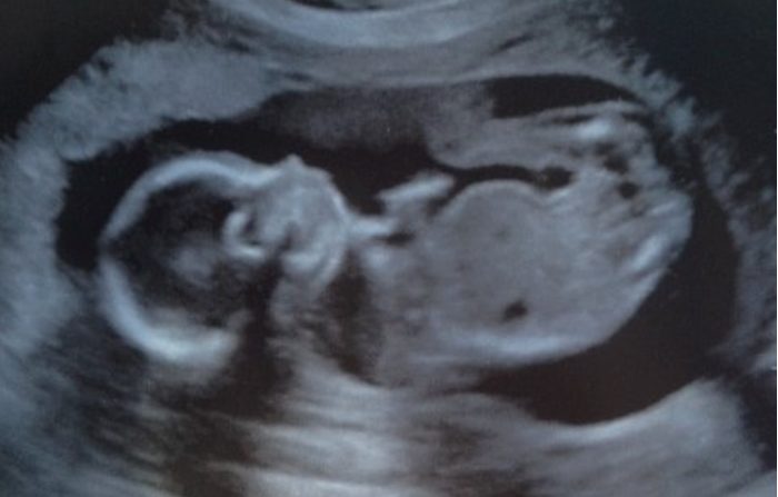 Alabama House Passes Bill Banning Abortion, Would Make Killing Unborn Babies a Felony