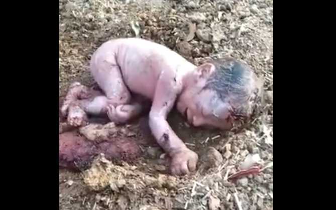 Video of New Born Baby Girl Abandoned in Indian Garbage Dump Leads to Adoption