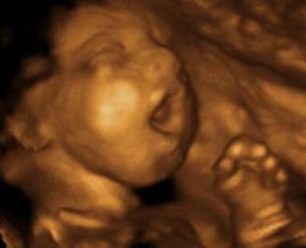 South Dakota Abortions Decline as More Babies Saved From Abortion