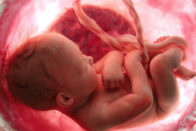 Abortion Was the Leading Cause of Death Worldwide Over Last 100 Years, Killing 1 Billion People