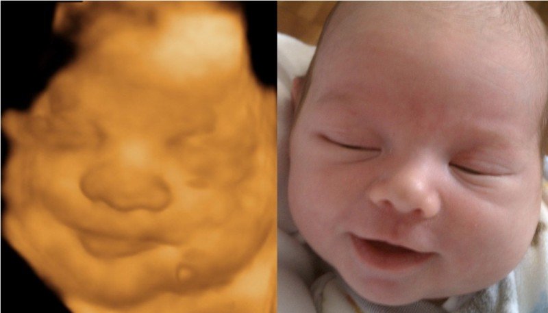 Good News: Iowa Legislature Passes Pro-Life Bill to Save Babies From Abortion