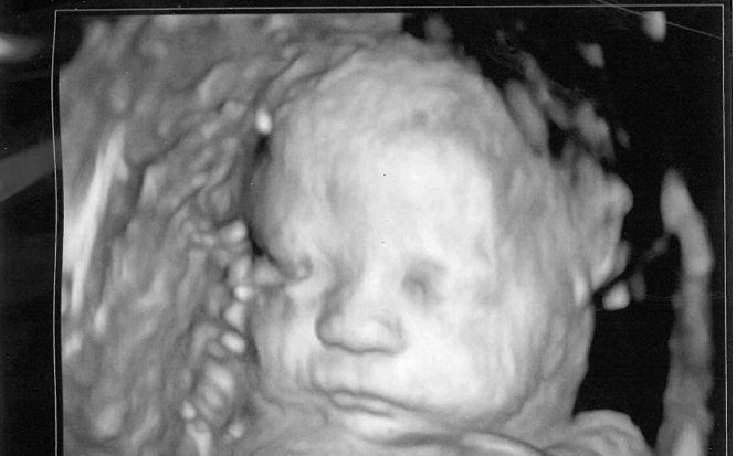 Bogus “Study” Done by Abortionists Claims 95% of Women Happy With Aborting Their Babies